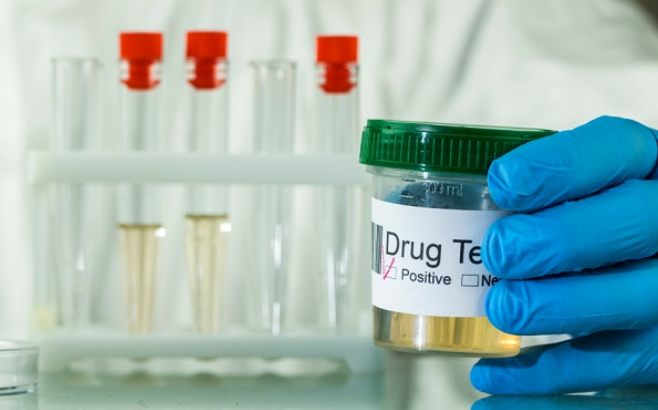 ensuring-your-well-being-navigating-drug-testing